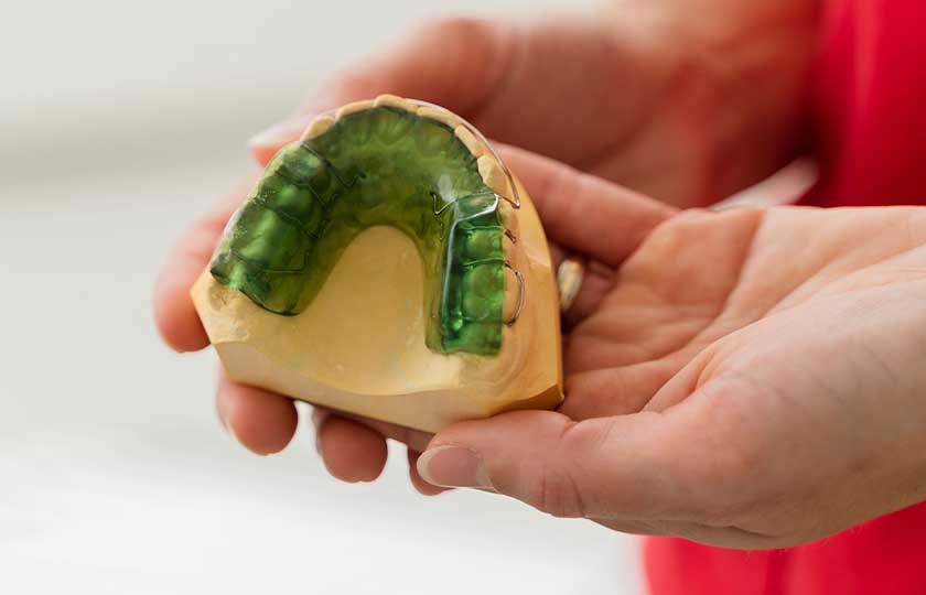 Modell eines Oberkiefers mit Zahnspange