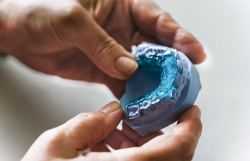 Hände halten Modell eines Oberkiefers mit herausnehmbarem Zahnabdruck