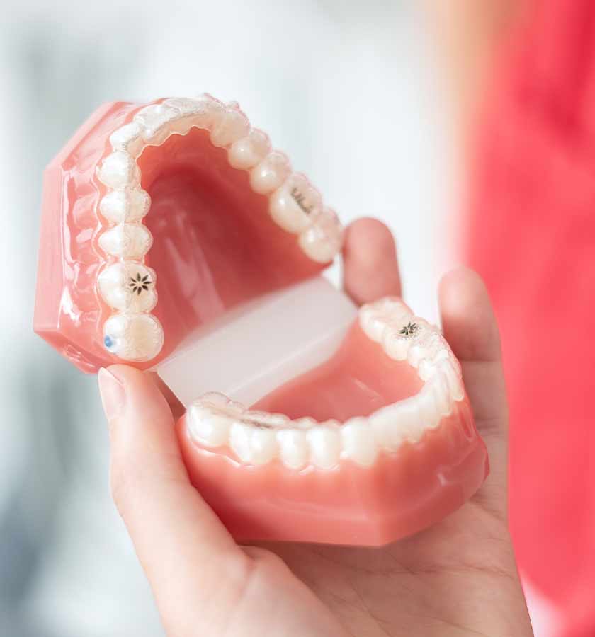 Von einer Hand gehaltenes Modell eines Gebisses mit transparenten Zahnschienen mit Invisalign-Logo. 