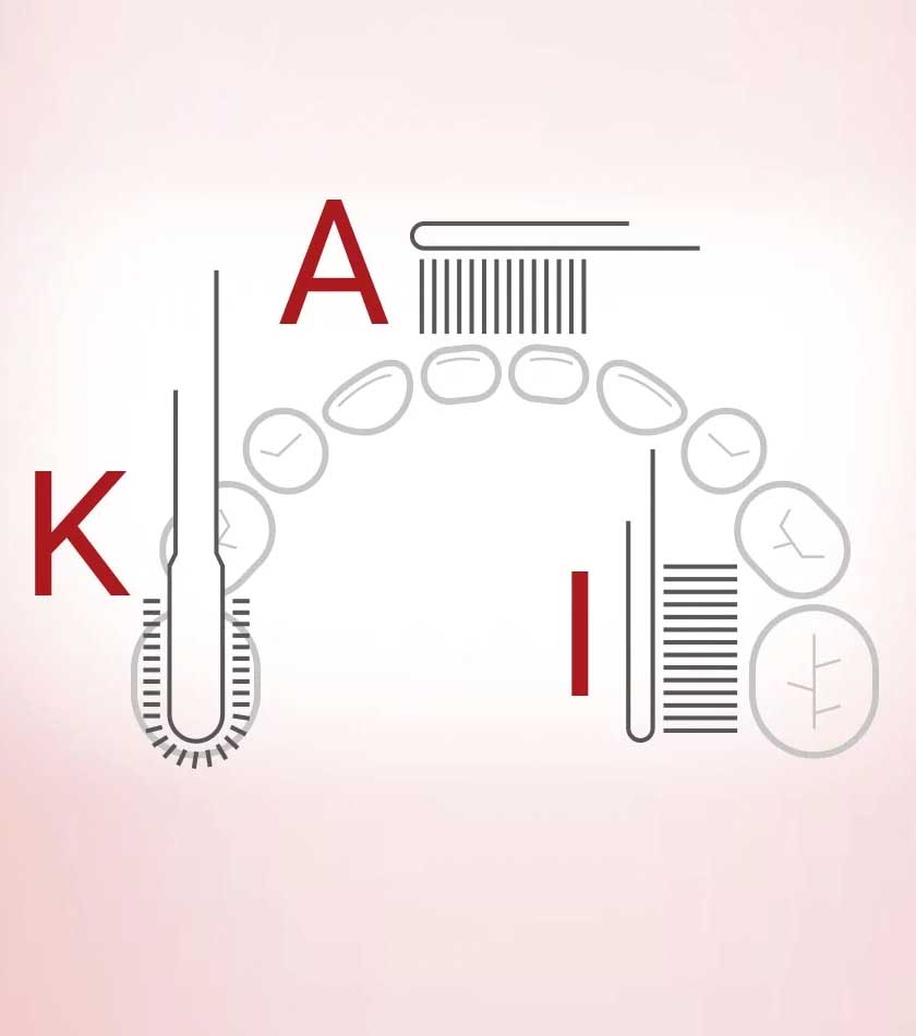 Unterkieferzeichnung mit Erläuterung der KAI-Putztechnik